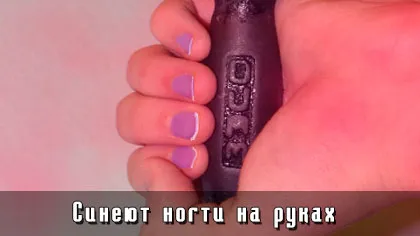 Станете сини нокти - кожни заболявания - лечение на заболявания - народни рецепти - namedne -