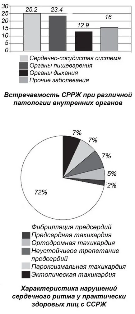 Синдромът на ранното камерна реполяризация какво е проява на ЕКГ