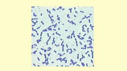 лечение Blood Streptococcus увеличи симптоми стрептокок