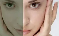 Дим тен - причини, симптоми, диагностика и лечение (тъпа тен) Тъпа тен - причини, симптоми, диагностика и лечение