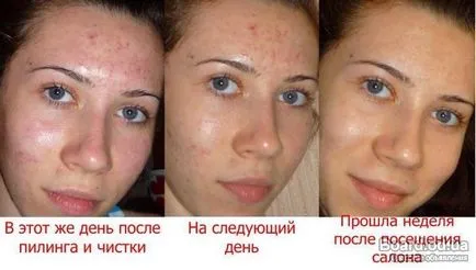 Ултразвуково почистване човек у дома си с помощта на отговорите на устройството и инструкциите видео