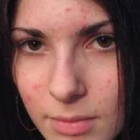 Грижа за врата как да се пазят тайната на неговата възраст