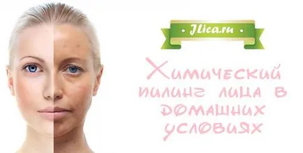 Химически пилинг на лицето видове, рецепти и коментари (химически) Химически пилинг на лицето видове, рецепти и коментари