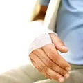 Immobilizáció - Immobilizáció - Medical Library