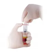 Botox Botox káros az a személy (a következményeket)