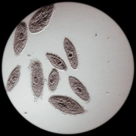Paramecium caudatum szerkezete, a test alakját, lakás (test) Paramecium caudatum szerkezete, a test alakját, élőhely