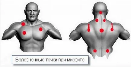Ако лечението на болки в ръката