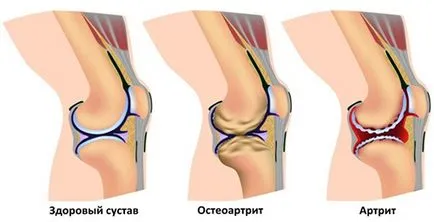 От това, което боли глезена От това, което боли глезена