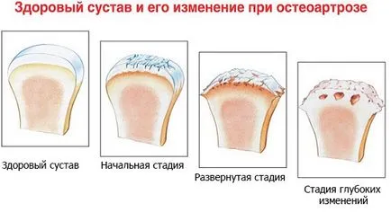 От това, което боли глезена От това, което боли глезена