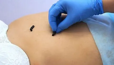 Болка в лакътя, отколкото лечение