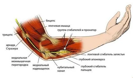 Болка в лакътя, отколкото лечение
