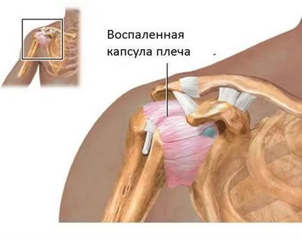 Ако лечението на болки в ръката