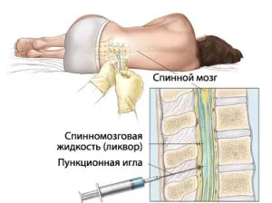 Какво е това, което пункция