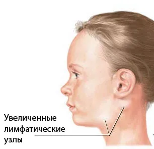 Симптомите на херпес
