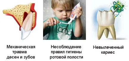 На венеца го абсцес