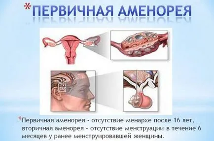 Хормонални момиче недостатъчност