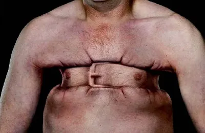 Hogy szívem fáj jelek és tünetek (fájdalom) Hogy szívem fáj tünetek és jelek