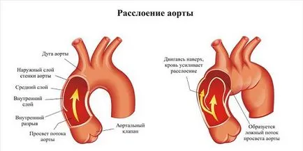 Hogy szívem fáj tünetek és jelek (szív) Hogy szívem fáj tünetek és jelek