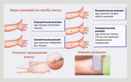 Hogyan lehet a ruha szakaszos eljárás leírása (bőrteszt) Hogyan lehet a ruha szakaszos eljárás leírása