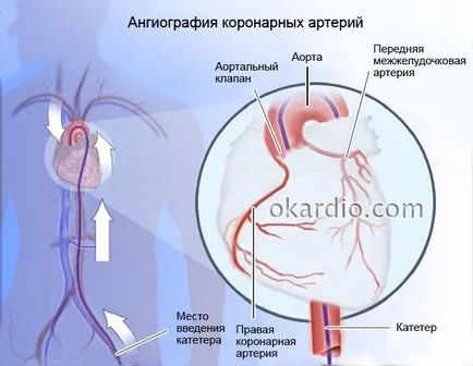 коронарните противопоказания