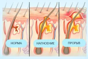 Какво трябва да направя, ако точката на кипене