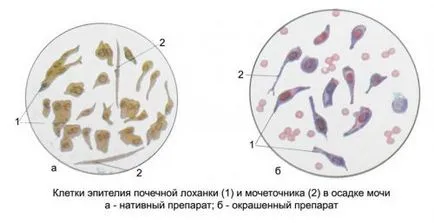 Бъбречното легенче и какво е