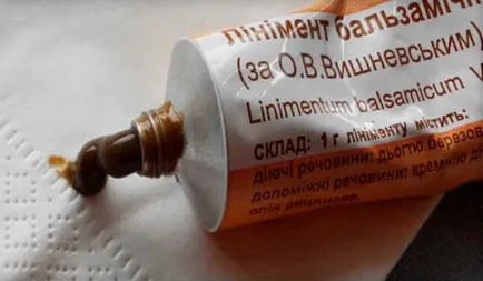 абсцес лечение на палеца
