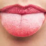 Невралгия на тройния нерв пречиствателни народни средства