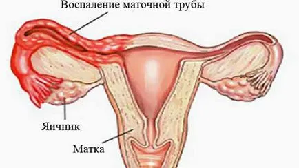 Какво силна селекция
