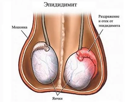 Подуване на тестис, че тя