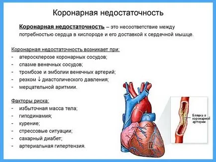 Хронична коронарна недостатъчност какво е
