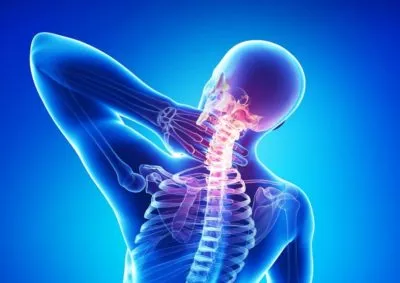 Hogyan kell helyesen erősíti az izmokat a nyak és osteochondrosis