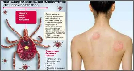 Milyen hatásai vannak a kullancscsípés emberben