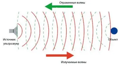 Сонография какво е Сонография какво е
