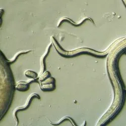 то Trichocephalosis