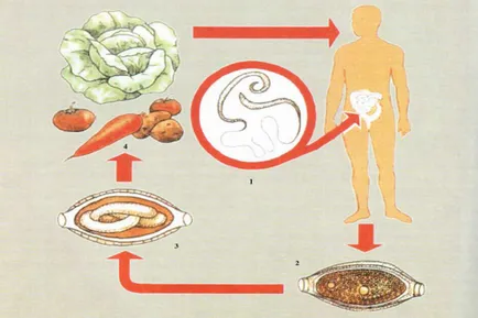 то Trichocephalosis