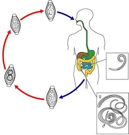 то Trichocephalosis