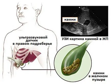 Узи вътрешните органи го Узи вътрешните органи го