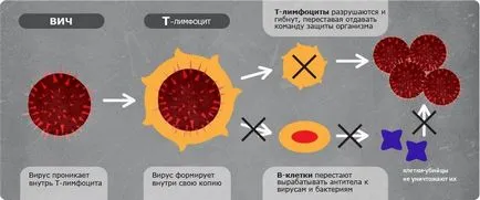 подути лимфни възли се отстраняват подути лимфни възли се отстраняват