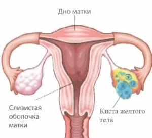 Каква е жълтото тяло на ултразвук