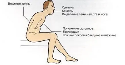 Вода в белите дробове, което е
