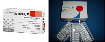 Анестезия при лекари по дентална медицина варианти, показания, противопоказания, модерен