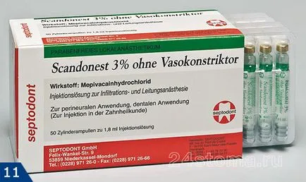 Анестезия стоматология ubistezin, septanest, skandonest - инструкции за употреба, ревюта, цена