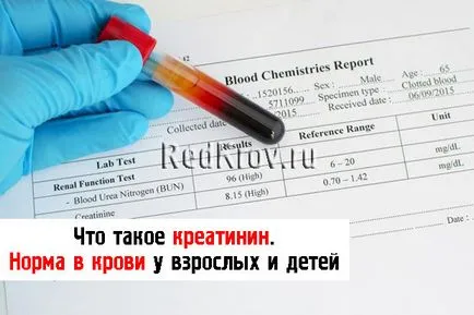 Какво е креатинин и неговата норма в биохимичен анализ на кръвта