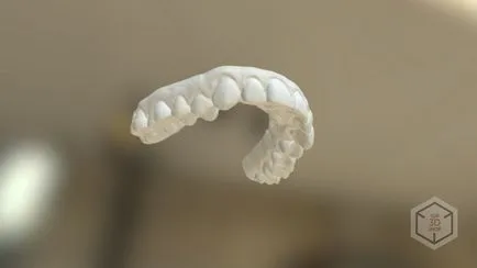 Ahogy teszteltük a harapás korrekciója aligners a mi rendező (3d-nyomtatás fogászat) Ahogy teszteltük a harapás korrekciója aligners a mi rendező
