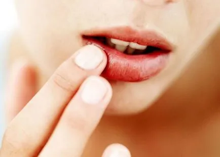 Hogyan kell kezelni a herpesz, a válaszokat a kérdéseidre (herpes otthon) Hogyan kell kezelni a herpesz, a választ kérdéseire