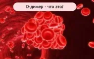 D-димер анализ които даряват кръв Scrubs (подаване) Д-димер, който се яви на изпит, кръв клиника