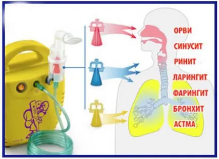 Вдишването пулверизатор, когато кашлица - кашлица (вдишване) Вдишването пулверизатор, когато кашлица - кашлица