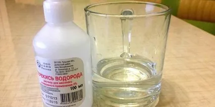 Как да избелите зъбите си у дома и ефективно, без вреда