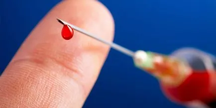Как е стафилококус ауреус инфекция от човешки възрастни и деца (прехвърлят) Как е стафилококус ауреус инфекция на човешките деца и възрастни